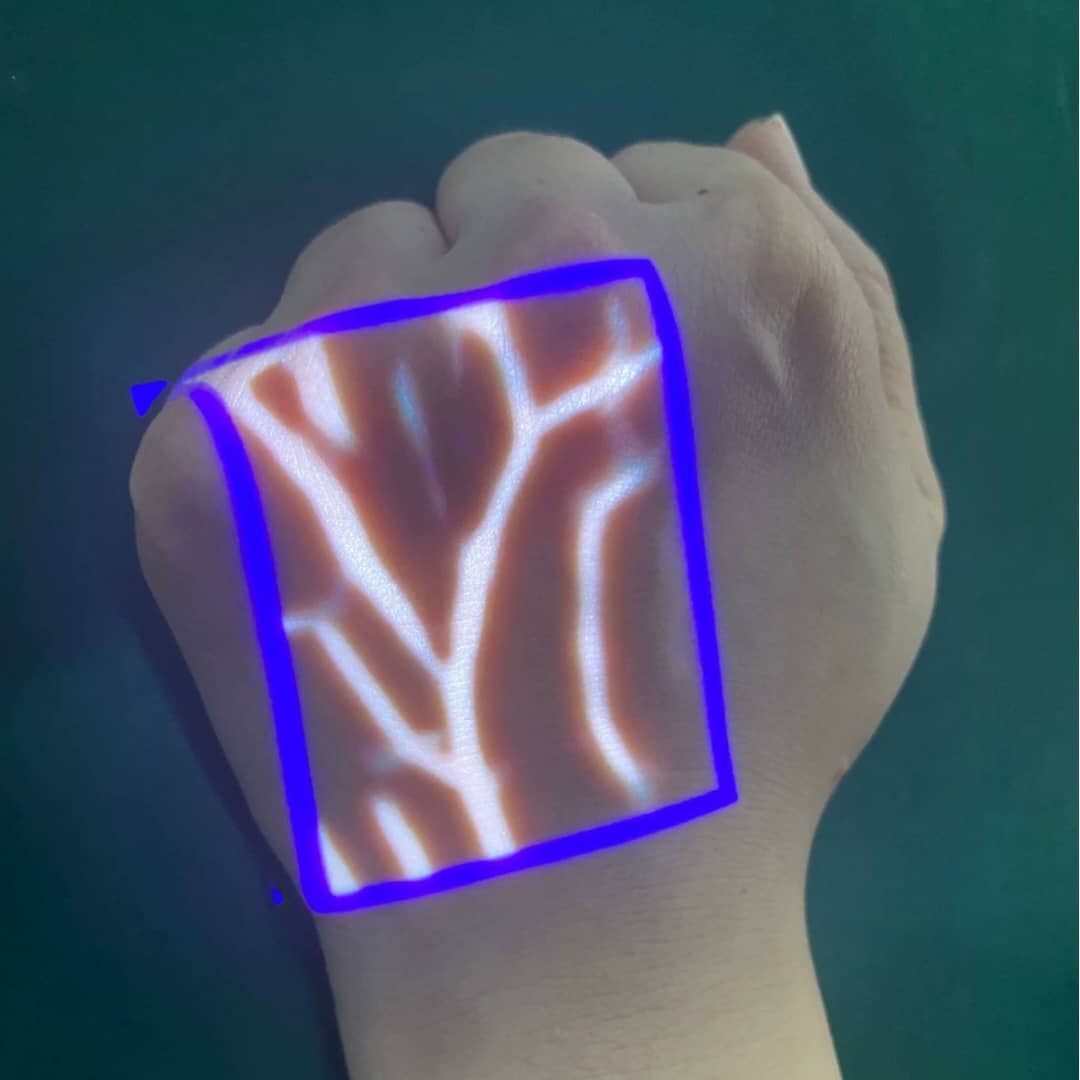 Dispositif médical - image 3